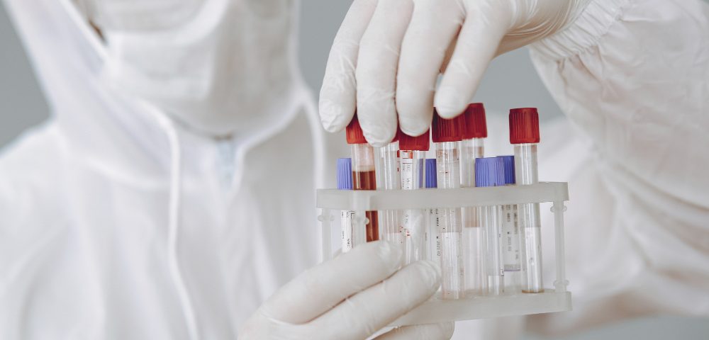 Muž pracujúci v laboratóriu